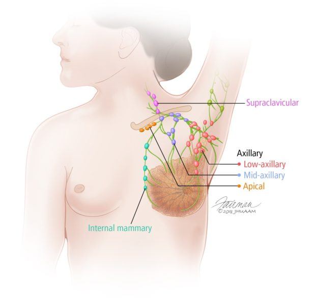 AXILLARY BREAST TISSUE  - by Poulomi Das - CollectLo
